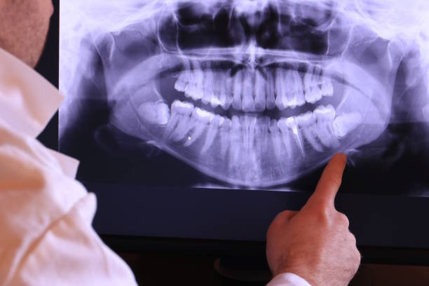 Best Broken or Chipped Tooth Repair in Radium Springs, NM